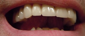 Zdrowe zęby
